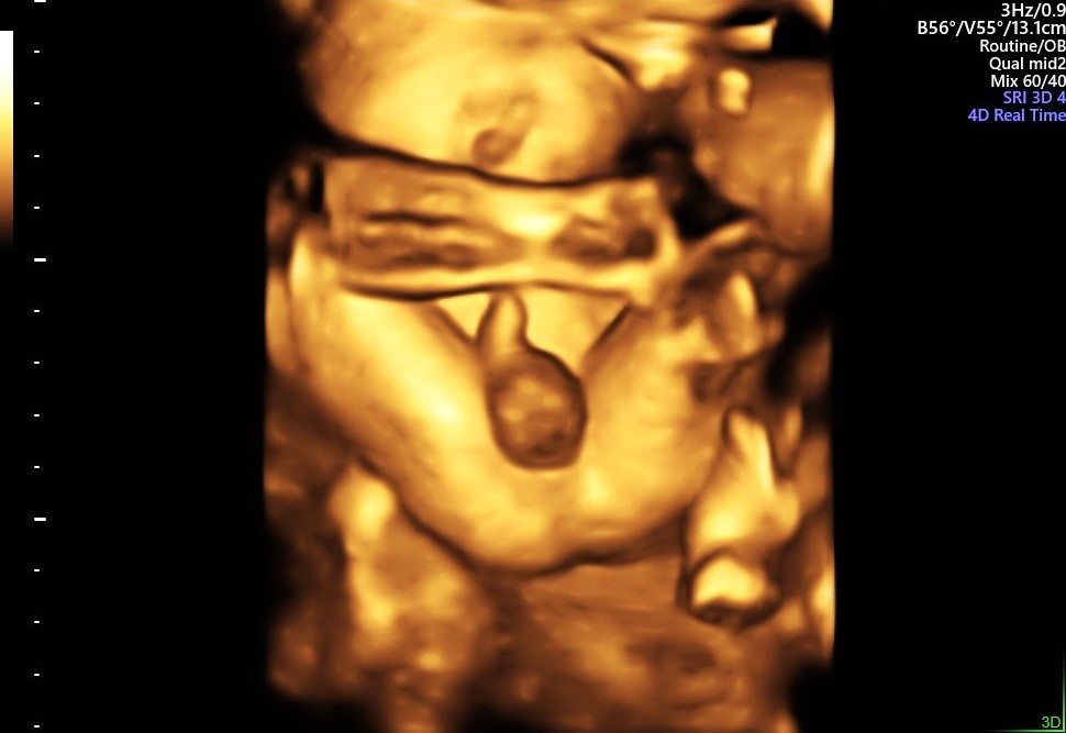 WhatsApp Image 2026-03-01 at 15.10.07